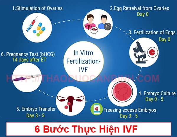 Các bước thực hiện IVF - Quy trình thực hiện thụ tinh nhân tạo