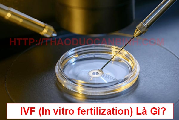 IVF - In vitro fertilization là gì?